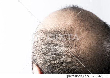 一個瘦頭髮的男人 一個瘦頭髮的男人 70782300