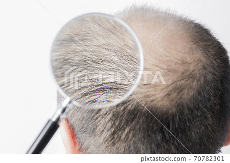 A thin hair man A thin hair man 70782301