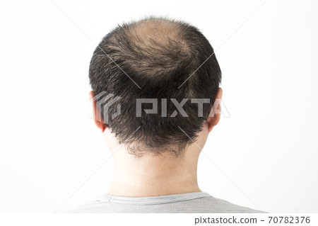 一個瘦頭髮的男人 一個瘦頭髮的男人 70782376