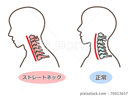 直頸智能手機的脖子等 70813637