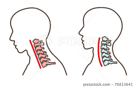直頸智能手機的脖子等 70813641