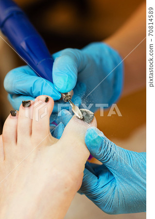 Chiropody. Hardware pedicure Chiropody. Hardware pedicure 70814589