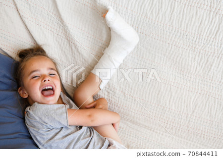 broken leg. Close-up of the cast on the feet. exercises to repair and strengthen muscles. damage to the bones. medical care of a surgeon in the emergency room 70844411