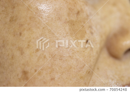 60多歲的女性臉上的污漬 70854248