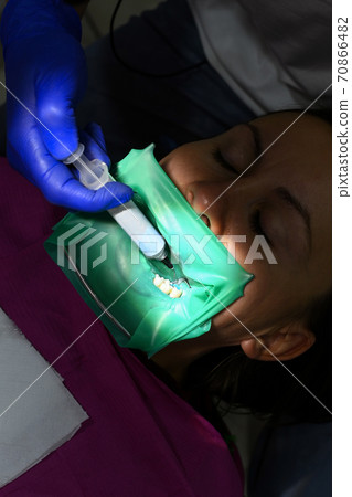 The dentist uses a blue gel to treat the patient's tooth. A woman at a dentist's appointment, a dentist uses a rubber dam and dental tools for treatment. The dentist uses a blue gel to treat the patient's tooth. A woman at a dentist's appointment, a dentist uses a rubber dam and dental tools for treatment. 70866482