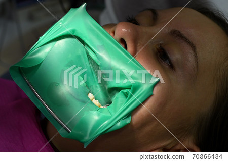 A woman at a dentist's appointment, a dentist uses a rubber dam and dental tools for treatment. A woman at a dentist's appointment, a dentist uses a rubber dam and dental tools for treatment. 70866484