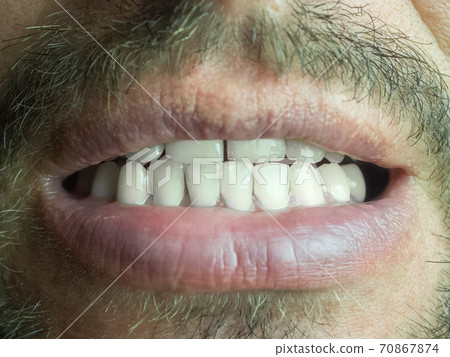 Fragment of a male face with a slightly open mouth and white teeth 70867874