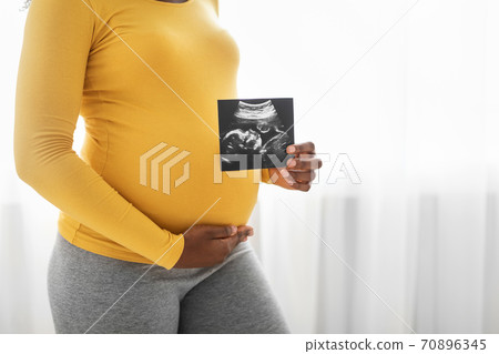 Pregnant black woman showing her baby sonography 70896345