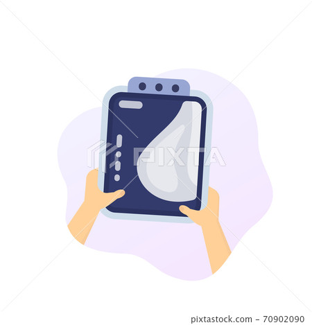 Mammogram in hands, breast scan, vector Mammogram in hands, breast scan, vector 70902090