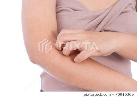 Female scratching her arm isolated white background. Medical, healthcare for advertising concept. 70910309