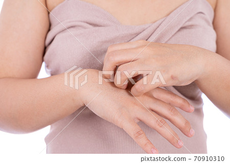 Female scratching her hand isolated white background. Medical, healthcare for advertising concept. Female scratching her hand isolated white background. Medical, healthcare for advertising concept. 70910310