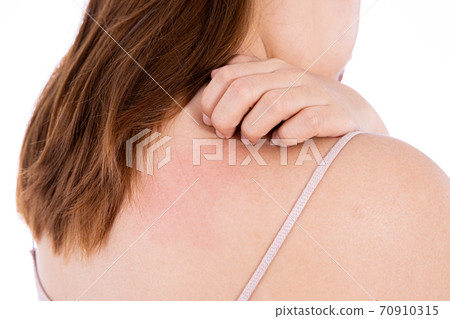 Female scratching her back isolated white background. Medical, healthcare for advertising concept. Female scratching her back isolated white background. Medical, healthcare for advertising concept. 70910315