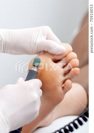 Peeling feet pedicure procedure on foot 70918053