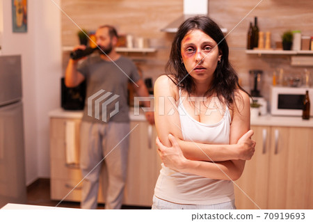 Victim of domestic violence Victim of domestic violence 70919693