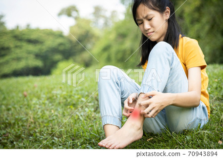 Asian child girl scratching itch on her leg with hand,female teenage with red rash,mosquito bite,fungal infection,insect bites,legs itching allergy,rash while sitting on the grass at park,Anaphylaxi Asian child girl scratching itch on her leg with hand,female teenage with red rash,mosquito bite,fungal infection,insect bites,legs itching allergy,rash while sitting on the grass at park,Anaphylaxi 70943894