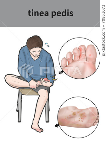 Illustration of a man without a species 70951073