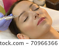 Woman Getting Laser Tattoo Procedure 70966366