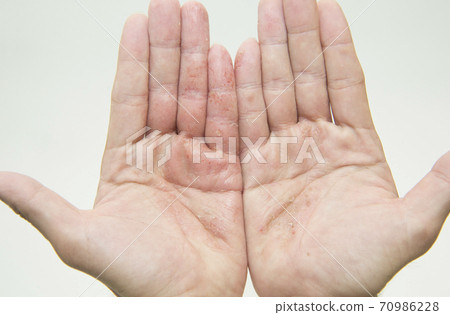 粗糙的手，與白色背景 70986228