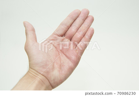 Rough hands with white background 70986230