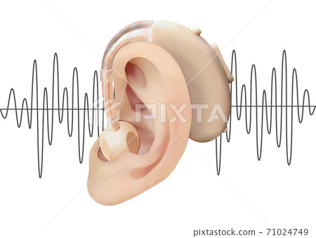Digital hearing aid behind the ear, on the background of sound wave diagram. Treatment and prosthetics of hearing loss in otolaryngology. Realistic vector illustration. Medicine and health. 71024749