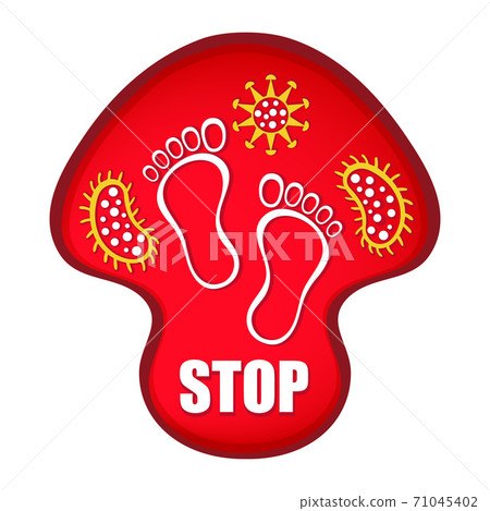 Stop foot nail fungus infection sign. Red mushroom with footprints and fungal bacteria in it. Skin diseases of legs, dermal treatment. Flat vector Stop foot nail fungus infection sign. Red mushroom with footprints and fungal bacteria in it. Skin diseases of legs, dermal treatment. Flat vector 71045402