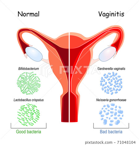 Vaginal flora. Good and bad bacteria that colonize vagina. 71048104