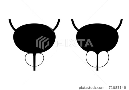 BPH info concept BPH info concept 71085146