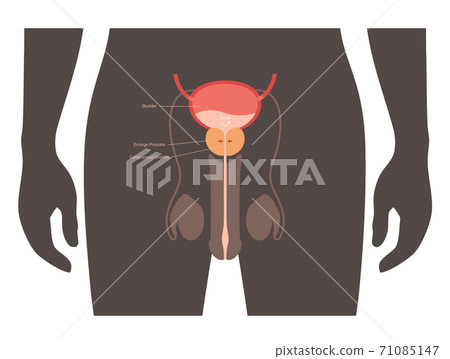 BPH info concept BPH info concept 71085147