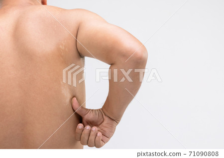 Macro white Pityriasis or Tinea Versicolor on back skin. Used for skincare concept Macro white Pityriasis or Tinea Versicolor on back skin. Used for skincare concept 71090808