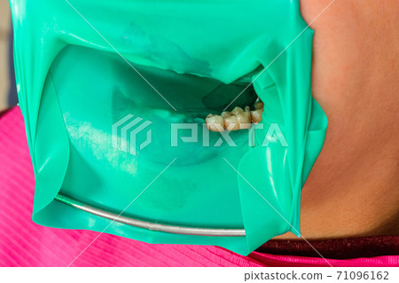 The dentist installs a rubber dam, sterile dental treatment, modern equipment in dentistry. 71096162