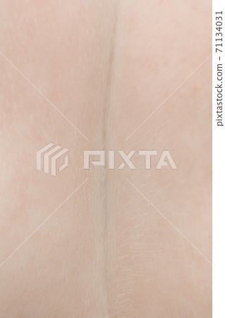 Close up portrait of beautiful albino woman isolated on studio background. Beauty, fashion, skincare, cosmetics concept. Details. Close up portrait of beautiful albino woman isolated on studio background. Beauty, fashion, skincare, cosmetics concept. Details. 71134031
