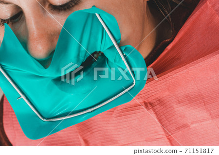 Installation of a cofferdam to the patient, modern dental equipment, treatment in sterile conditions. Installation of a cofferdam to the patient, modern dental equipment, treatment in sterile conditions. 71151817