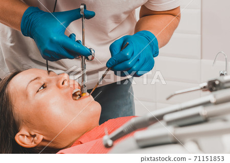 Local anesthesia, dentist carpal syringe injects the patient's gum anesthesia, dental carpule syringe. 71151853