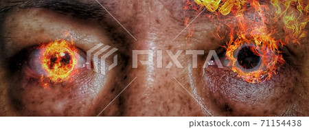 Close-up of burning eyes Close-up of burning eyes 71154438