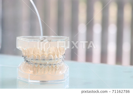 Dental model Dental model 71162786