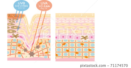 Ultraviolet (UVA / UVB) skin damage diagram 71174570