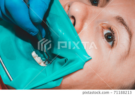 treatment of a chewing tooth, the dentist put a rubber dam, uses sterile tools, uses modern technology. treatment of a chewing tooth, the dentist put a rubber dam, uses sterile tools, uses modern technology. 71188213