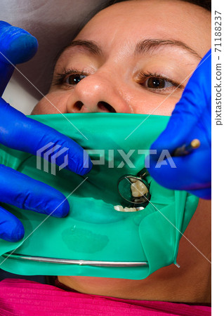 The dentist treats the patient's tooth with a rubber dam, drill, mirror. The dentist treats the patient's tooth with a rubber dam, drill, mirror. 71188237