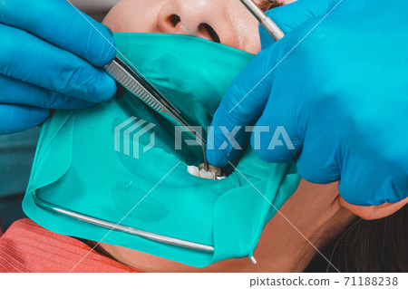 The dentist treats the patient's tooth with a rubber dam, drill, mirror. The dentist treats the patient's tooth with a rubber dam, drill, mirror. 71188238