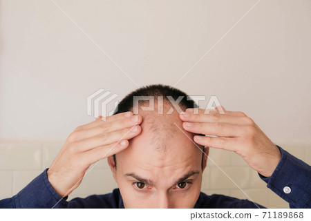 Young man looking at mirror worry about balding. Young man looking at mirror worry about balding. 71189868