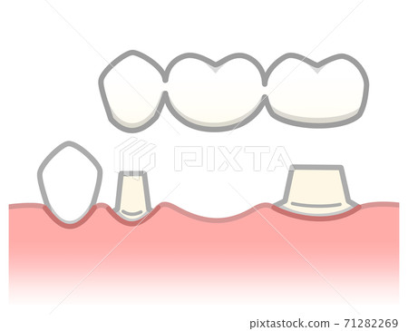 Bridge illustration 71282269