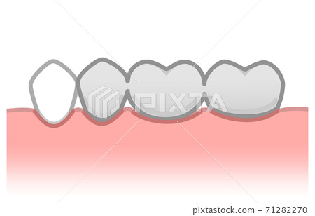 Bridge illustration 71282270