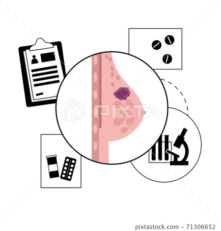 Breast disease concept Breast disease concept 71306652