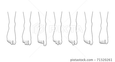 Foot toe shape types set. - Stock Illustration [71320261] - PIXTA