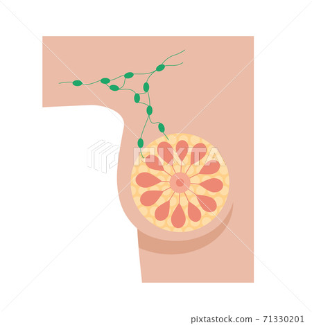 Breast disease concept 71330201