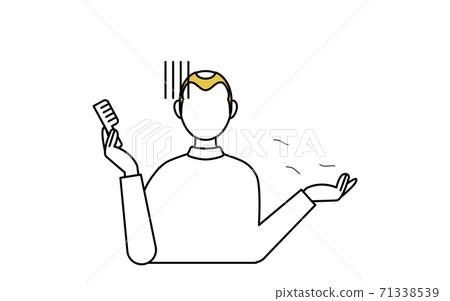 Illustration of a man with AGA androgenetic alopecia: pale to hair loss 71338539