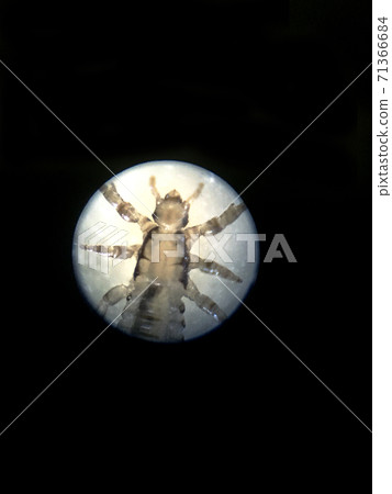 Head lice Head lice 71366684