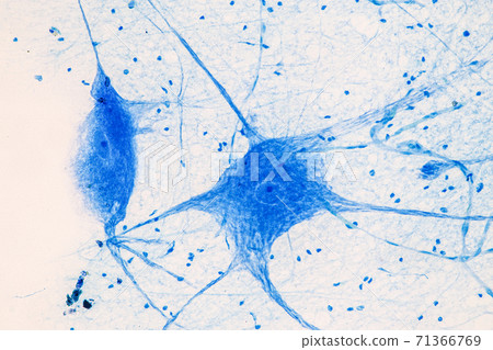 Education Spinal cord  and Motor Neuron under the microscope in Lab. 71366769