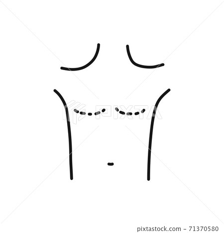 mastectomy doodle icon, vector line illustration mastectomy doodle icon, vector line illustration 71370580