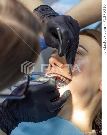 A woman at a dentist's appointment to replace arches with braces 71379310